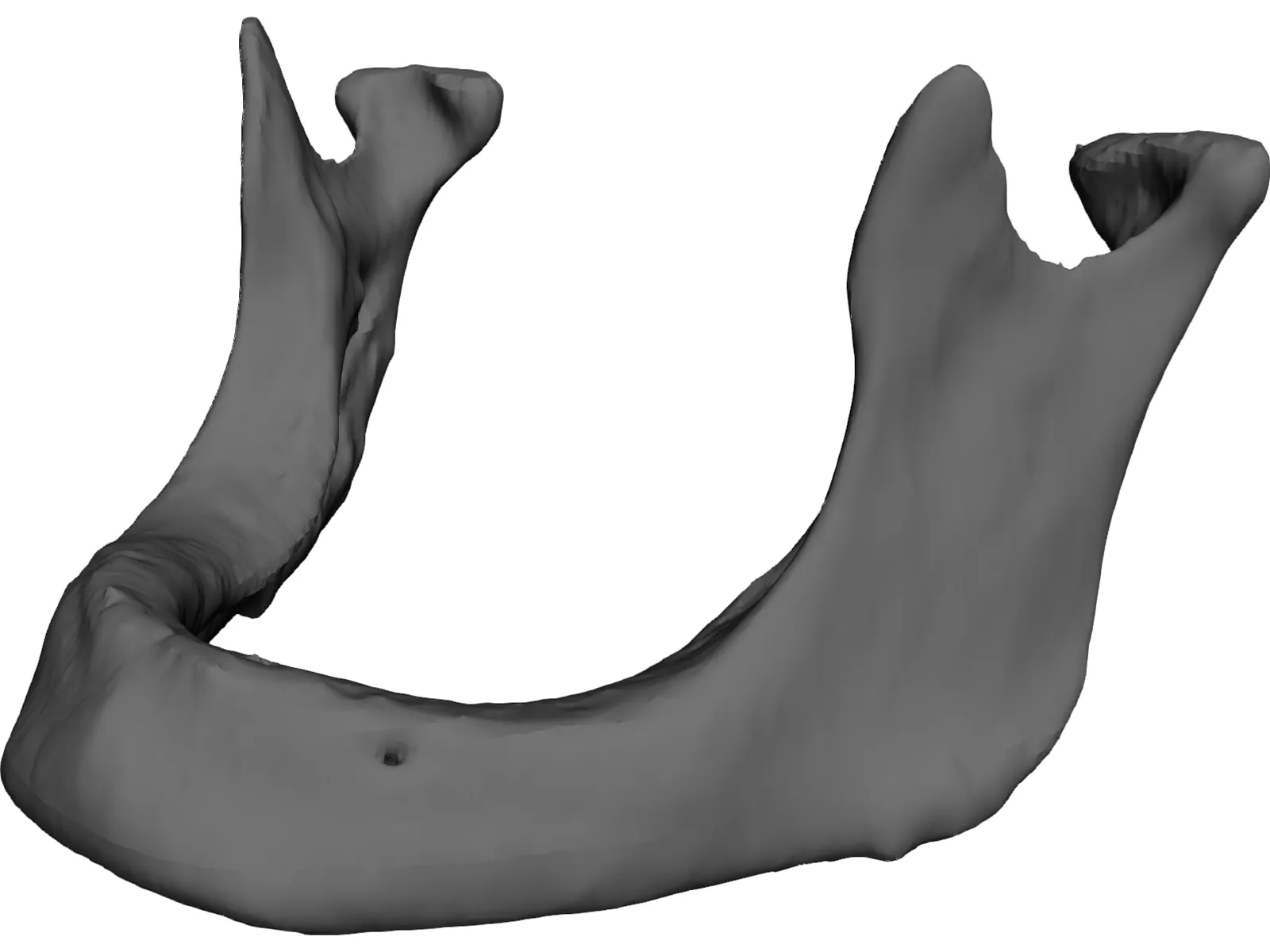 Edentulous Jaw 3D Model