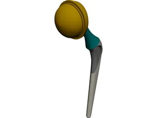 Artificial Hip 3D Model