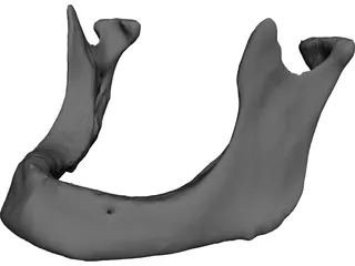 Edentulous Jaw 3D Model