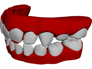 Teeth Childs 3D Model
