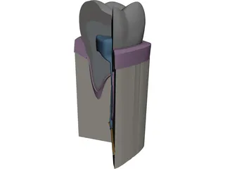 Molar Cutaway 3D Model