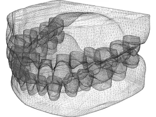 Teeth and Gums 3D Model