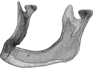 Edentulous Jaw 3D Model