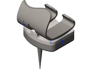 Knee Implant 3D Model