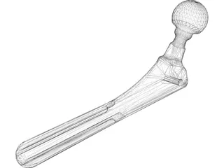 Hip Prosthesis 3D Model