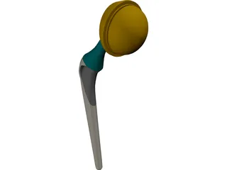 Artificial Hip 3D Model