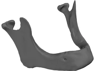 Edentulous Jaw 3D Model