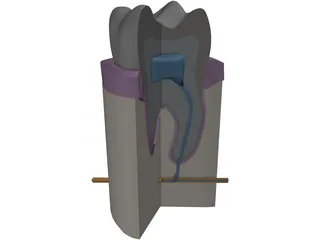 Molar Cutaway 3D Model