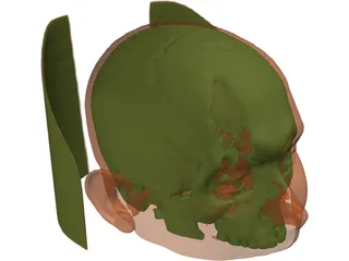 Human Skull InVesalius 3D Model