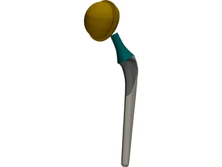 Artificial Hip 3D Model