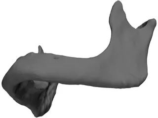 Edentulous Jaw 3D Model