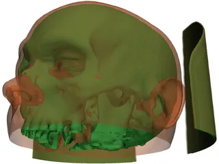 Human Skull InVesalius 3D Model