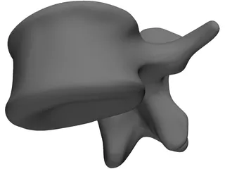 Vertebral Body 3D Model