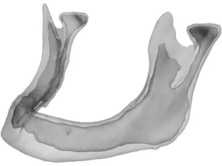 Edentulous Jaw 3D Model