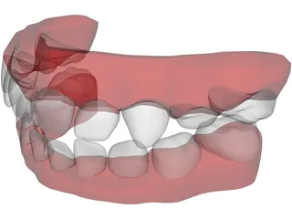 Teeth Childs 3D Model