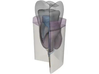 Molar Cutaway 3D Model